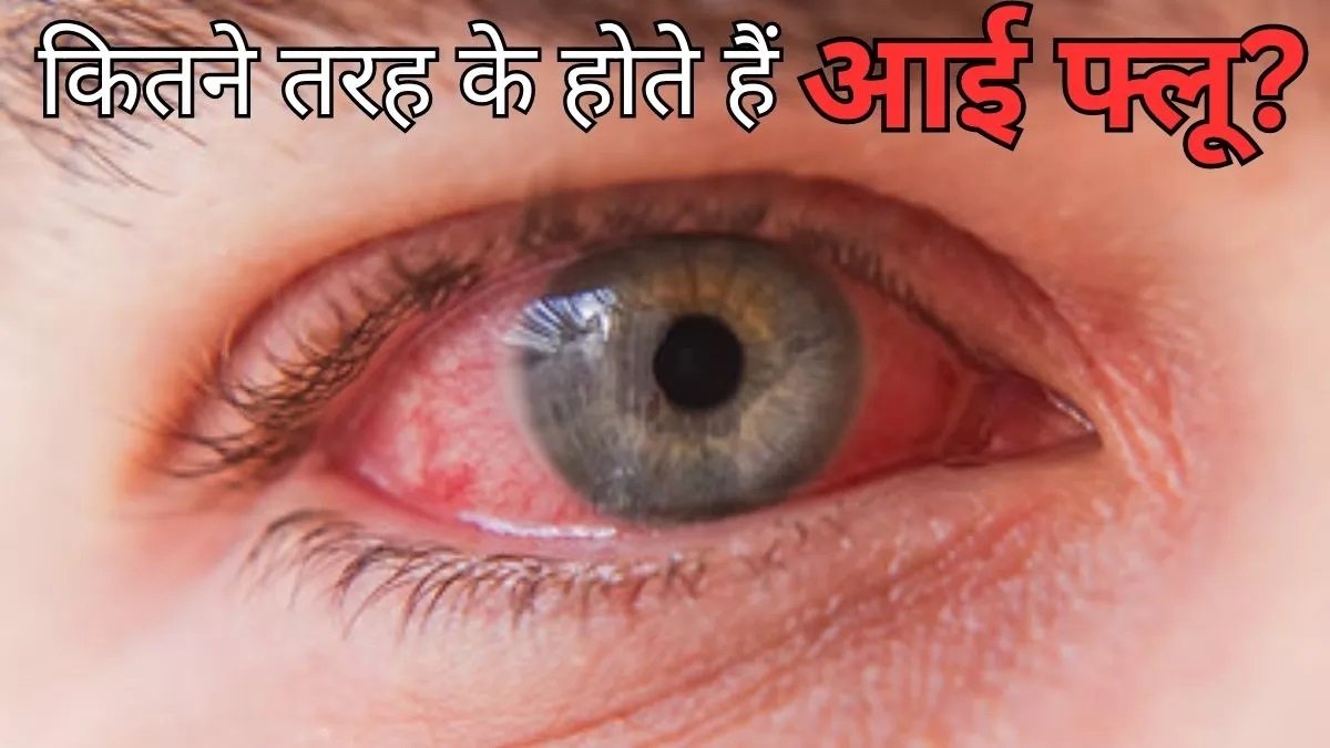 Eye Flu - कितनी तरह के होते है 'आई फ्लू', जानिए कौन-सा है सबसे खतरनाक,