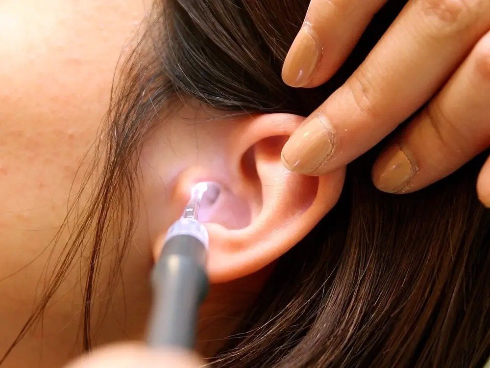 How To Remove Ear Wax - Easy way to remove the dirt accumulated inside the ear