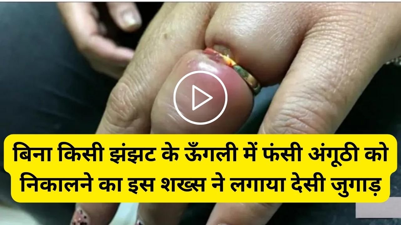 Desi Jugaad: बिना किसी झंझट के ऊँगली में फंसी अंगूठी को निकालने का इस शख्स ने लगाया देसी जुगाड़, जुगाड़ देख आप भी रह जाओगे हक्के बक्के