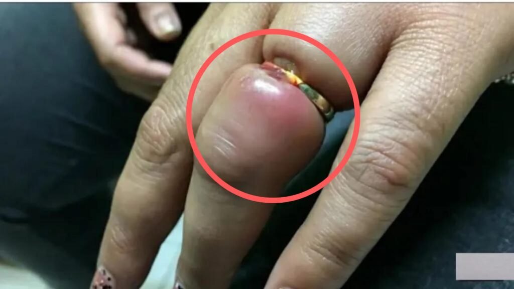 Desi Jugaad: बिना किसी झंझट के ऊँगली में फंसी अंगूठी को निकालने का इस शख्स ने लगाया देसी जुगाड़, जुगाड़ देख आप भी रह जाओगे हक्के बक्के