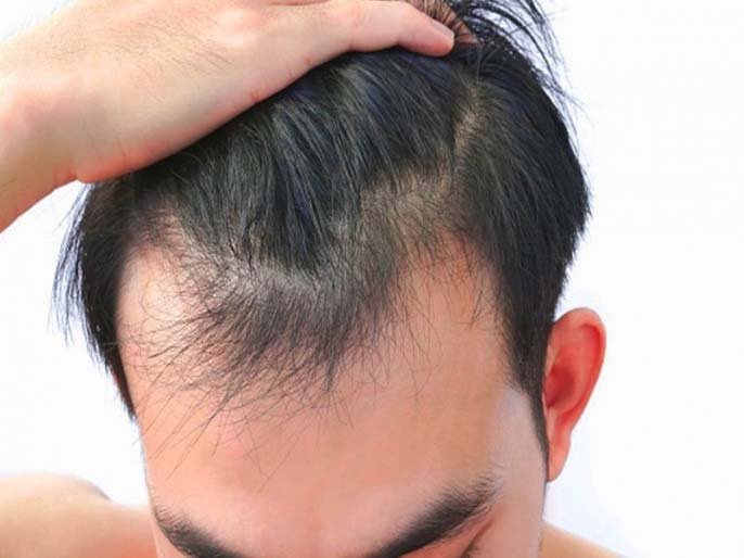 Oils For Hair Growth: These 3 hair oils are effective in getting rid of baldness.